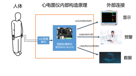 心电图仪构造