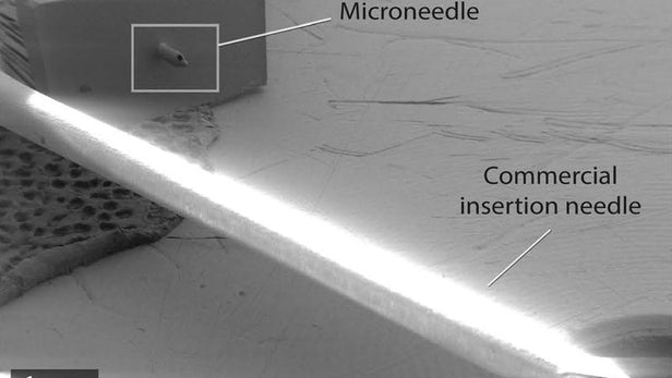 microneedle-glucose-monitoring-1.jpg